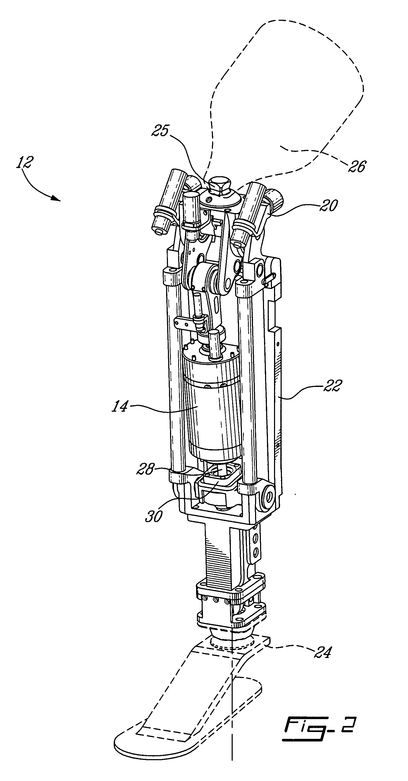 Control device and system for controlling an actuated prosthesis