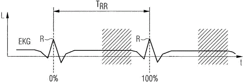 Improved multi-segment image reconstruction for cardiac computed tomography acquisitions