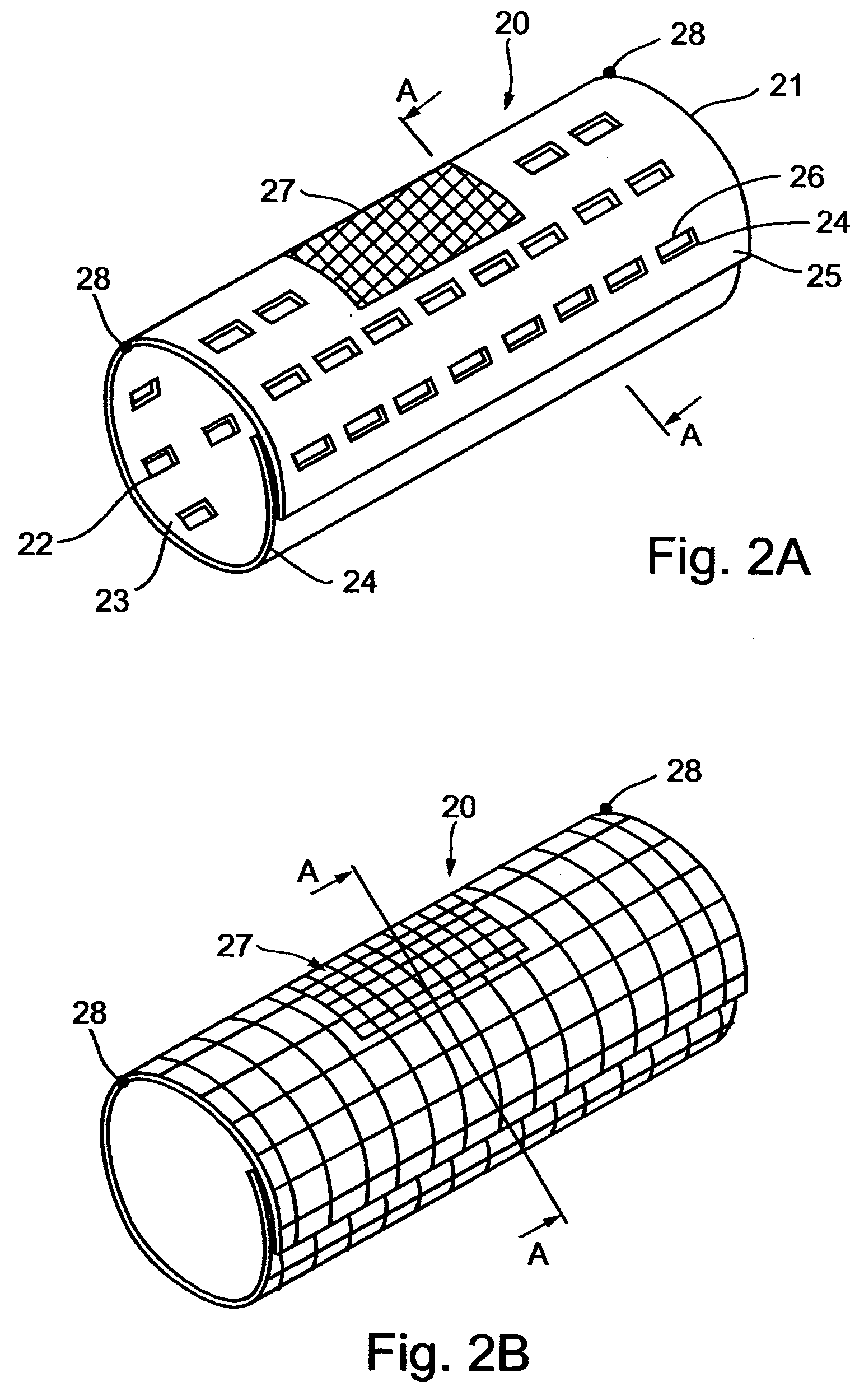Implantable integral device and corresponding method for deflecting embolic material in blood flowing at an arterial bifurcation