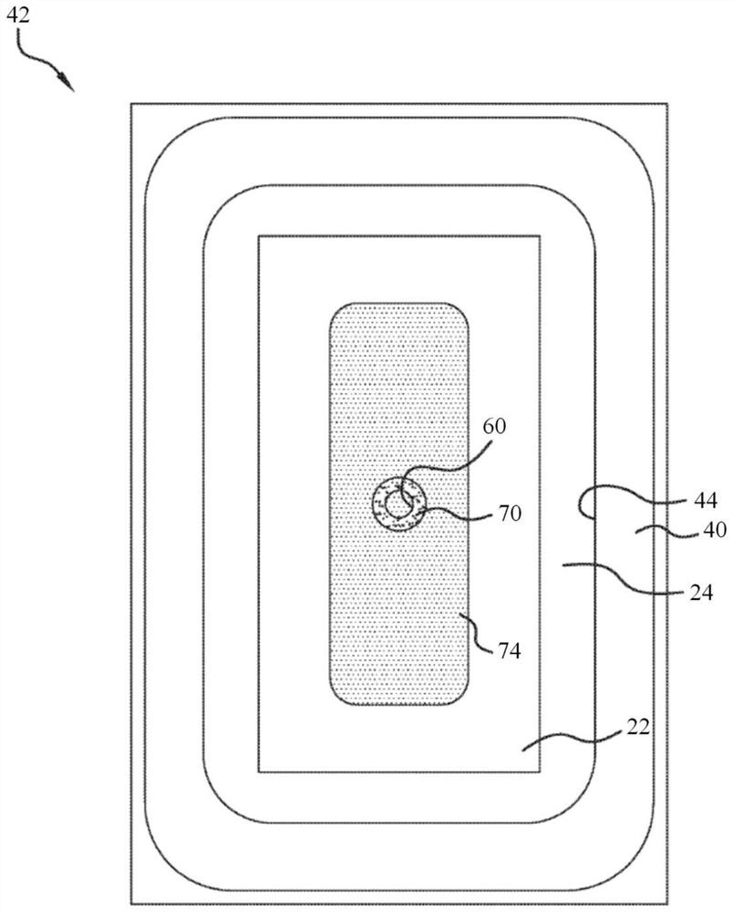 Negative pressure device having oxygen scavenger and volume reduction