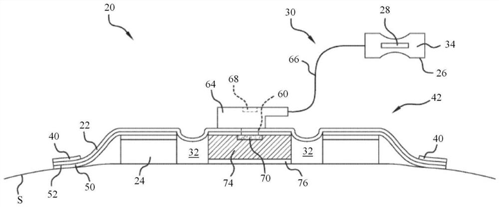 Negative pressure device having oxygen scavenger and volume reduction