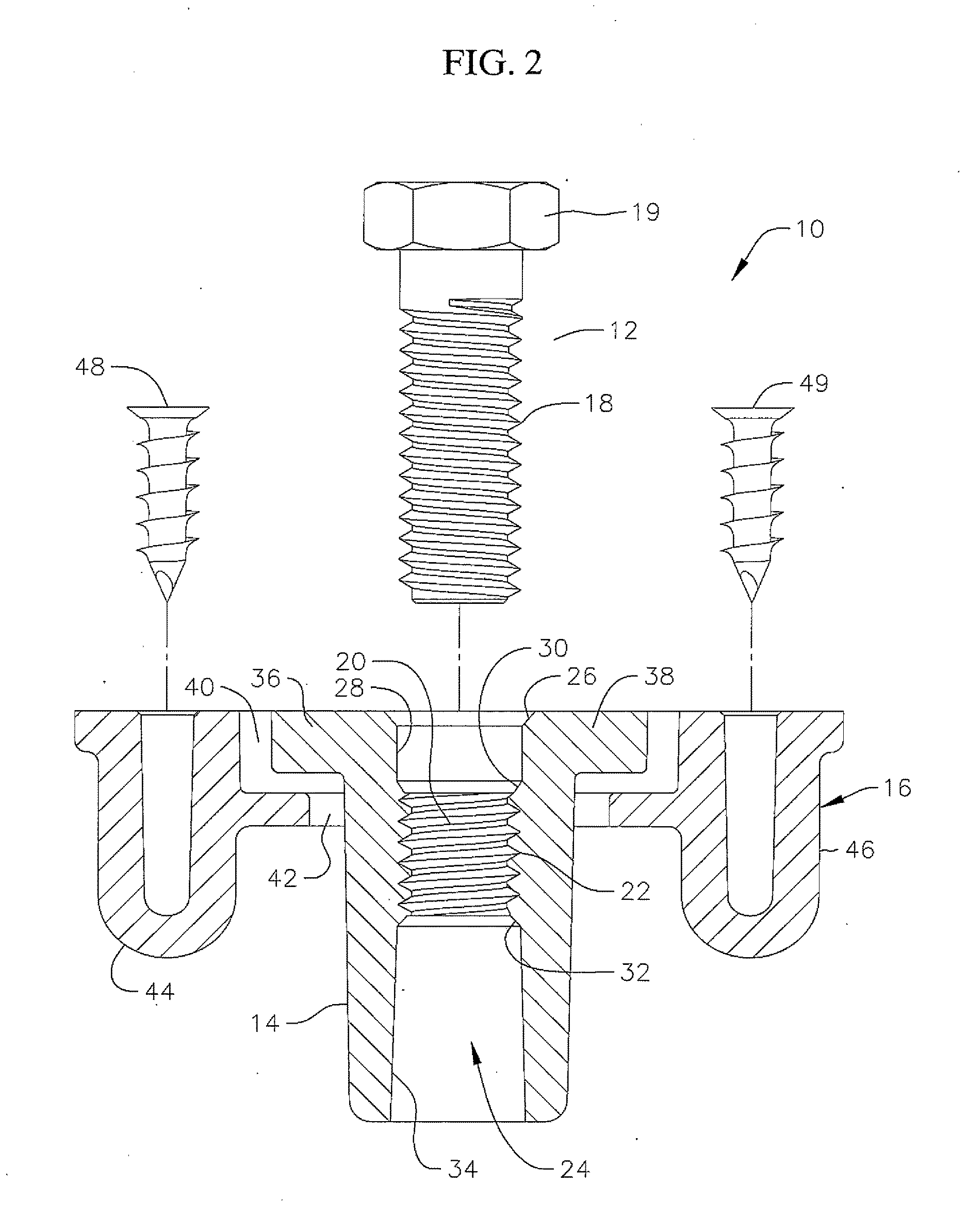 Fastening system allowing component removal after fastener system failure