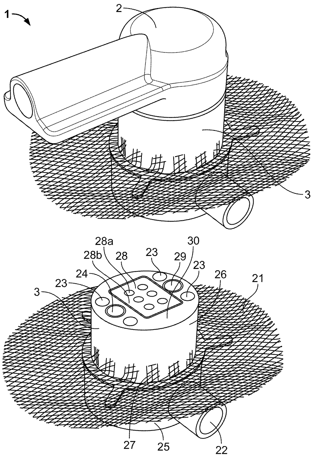 Percutaneous connector and associated methods of use