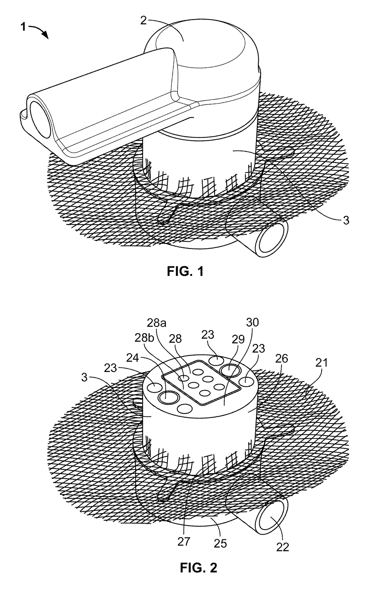 Percutaneous connector and associated methods of use