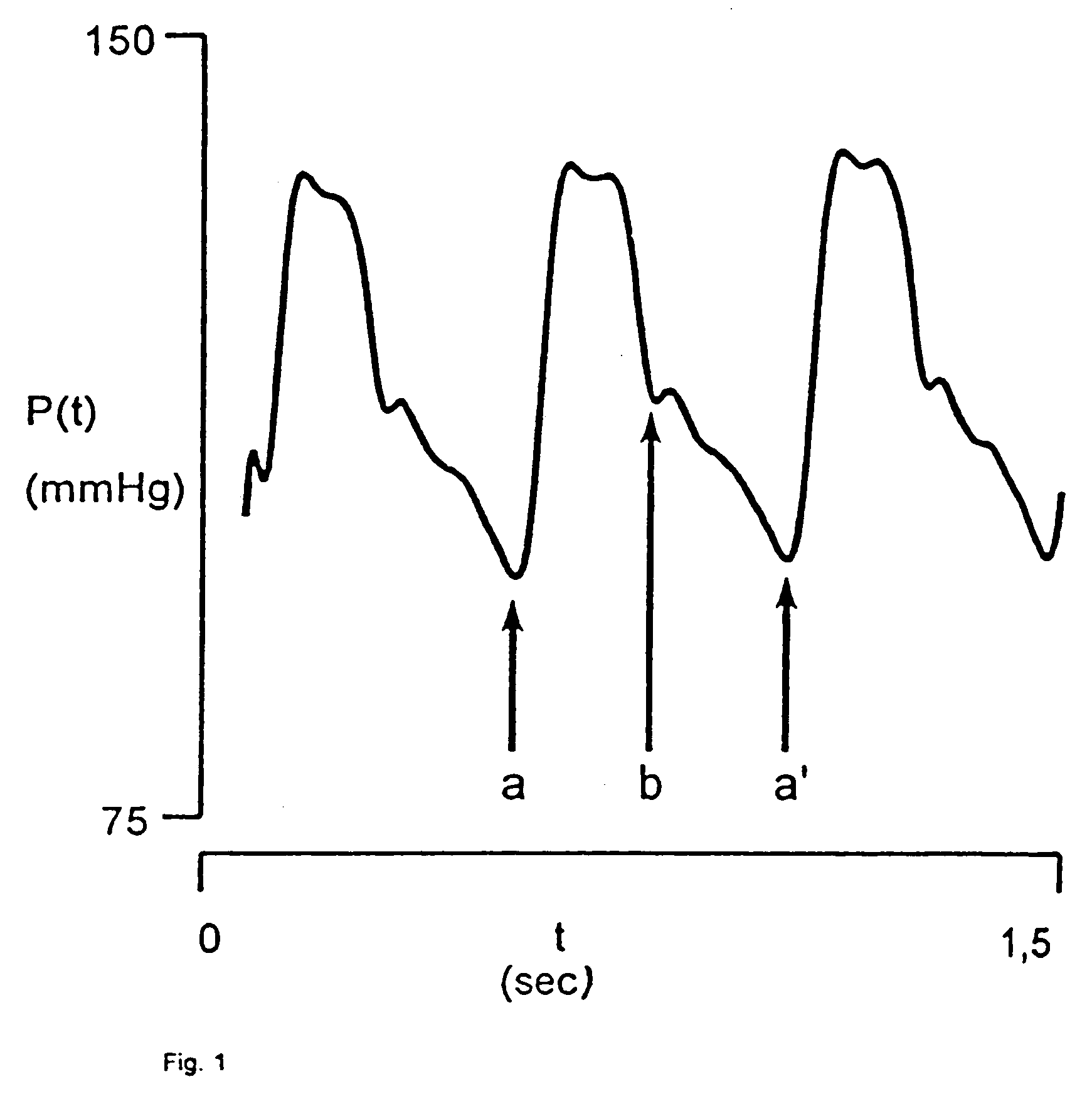 Device for determining a characteristic point in the cardiac cycle