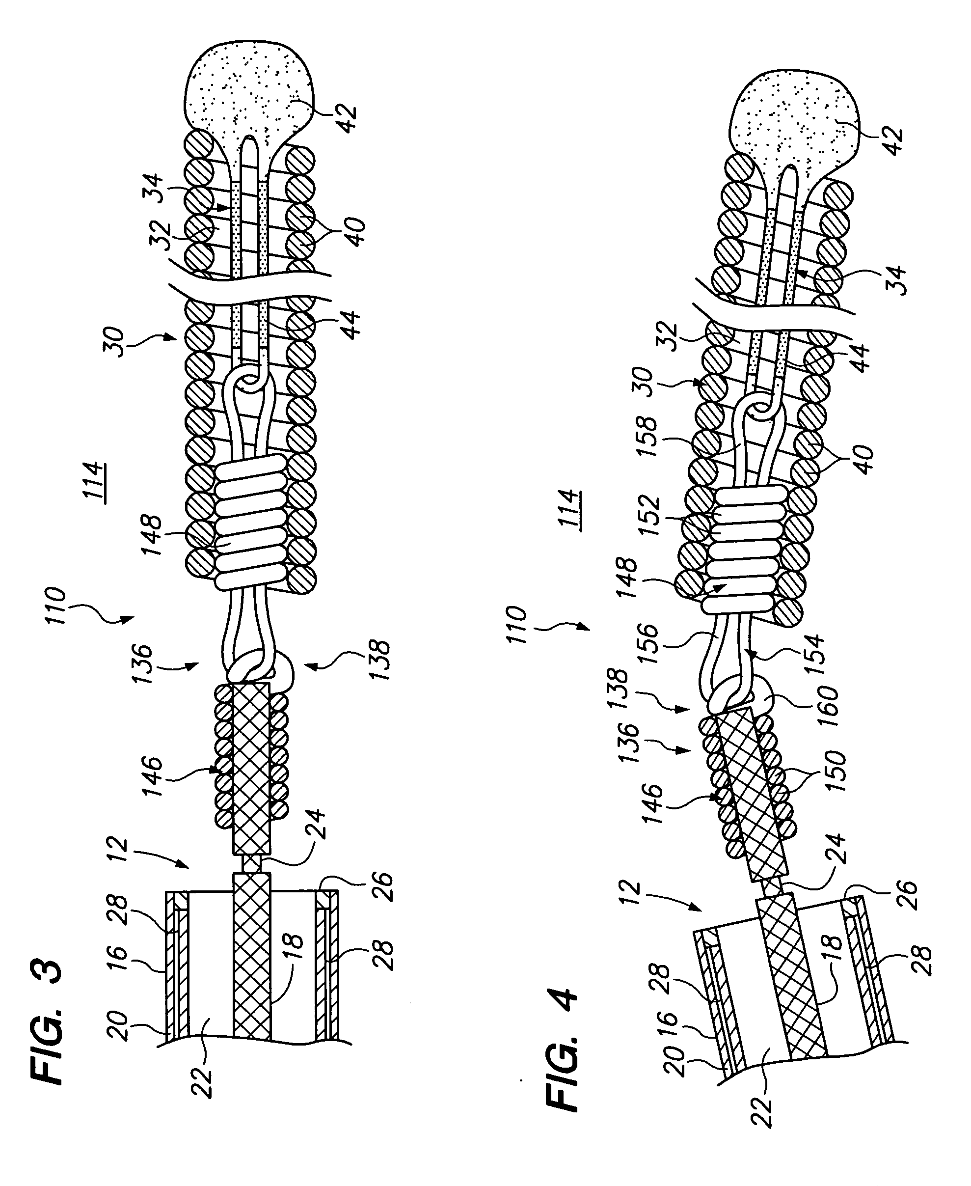 Vaso-occlusive device having pivotable coupling