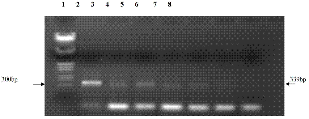 Primers, kit and detection method for detecting bean yellow mosaic virus