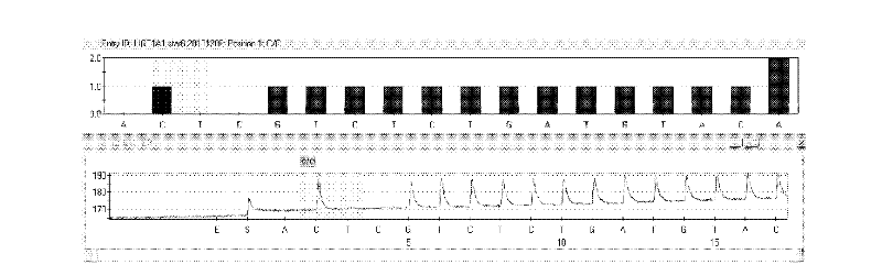 Kit and method for detecting gene polymorphism of irinotecan personalized medicine by pyrophosphoric acid sequencing method