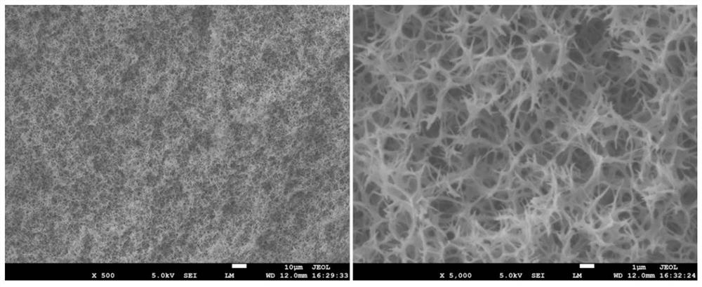 Chitosan/nano-metal composite hydrogel as well as preparation method and application thereof