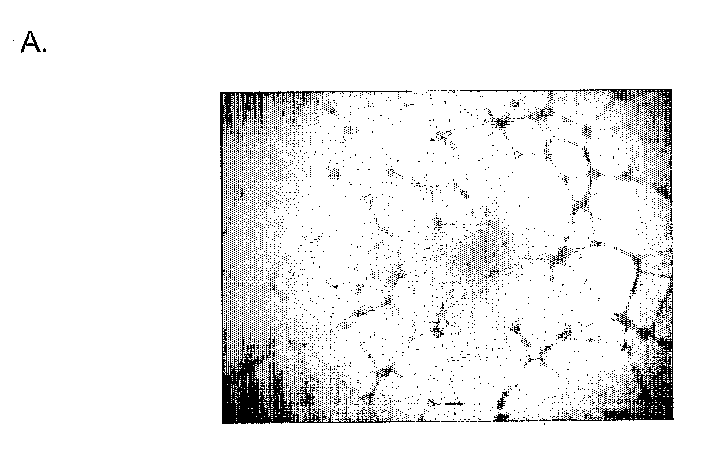 Methods and Therapeutic Compositions Comprising Plant Extracts for the Treatment of Cancer