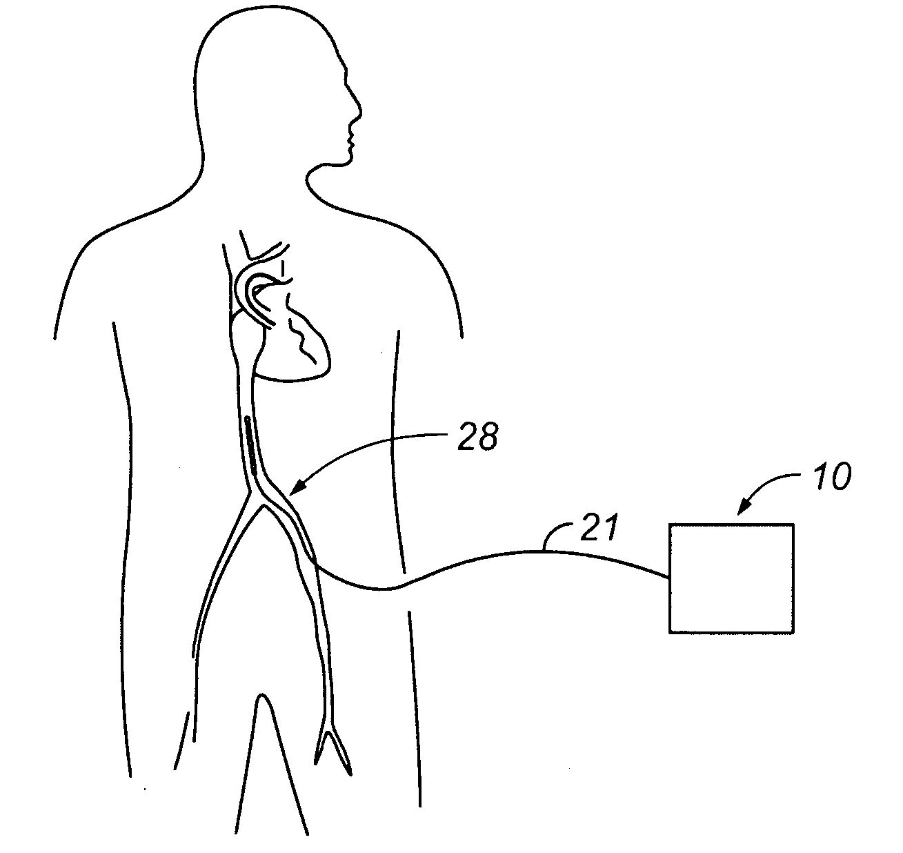 Devices and methods for using endovascular cooling to treat septic shock and other disorders