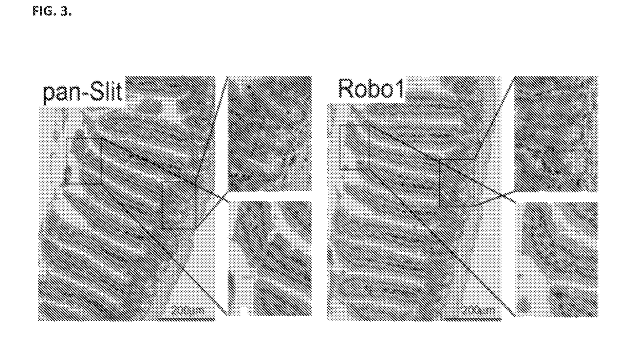 Compositions and methods relating to induction of intestinal stem cell homeogenesis and/or regeneration