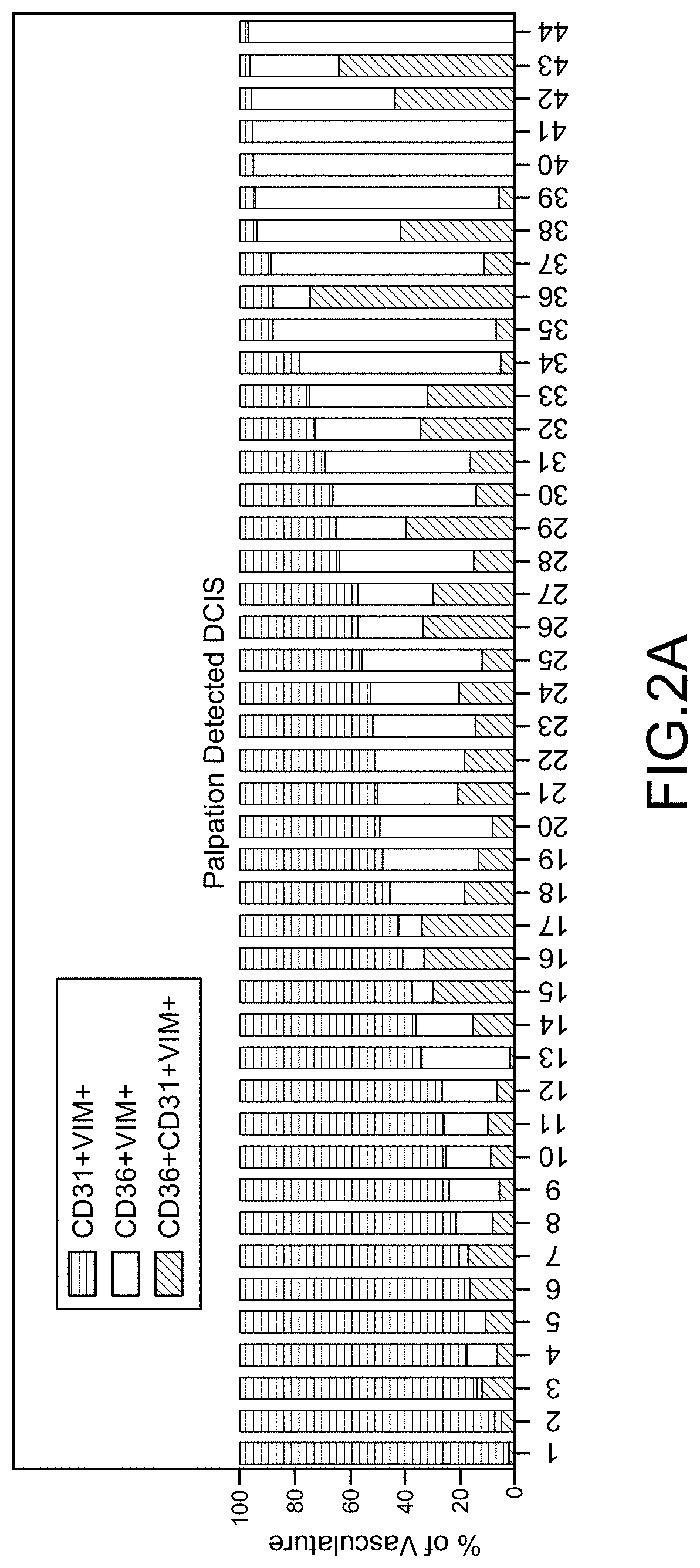 Cancer Progression Risk Assessment by Microvascular Phenotype