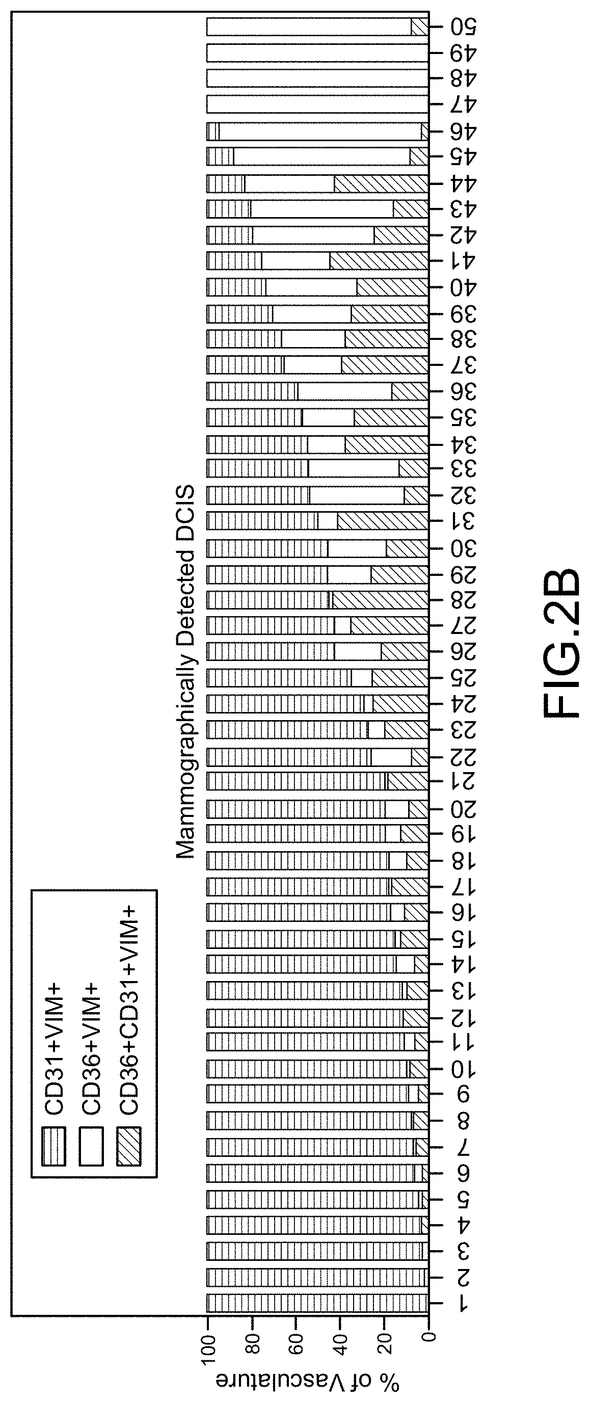 Cancer Progression Risk Assessment by Microvascular Phenotype