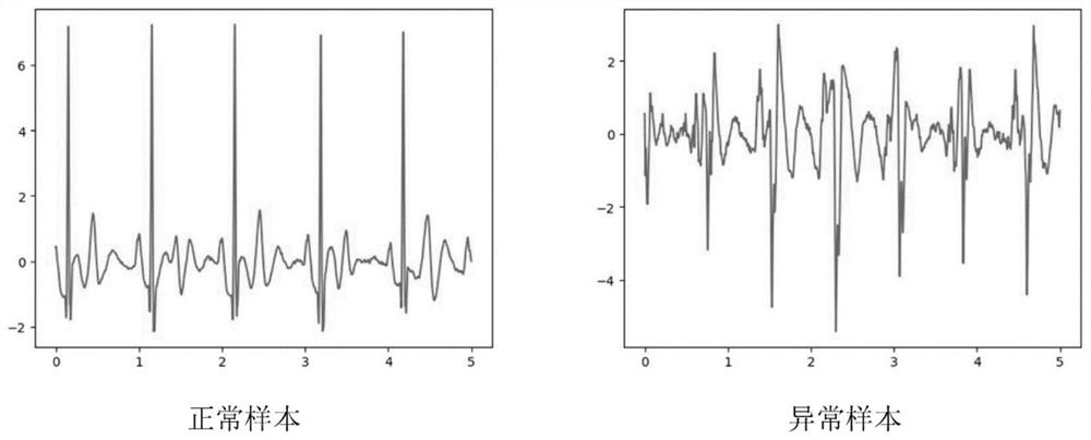 An ECG signal detection device and analysis method based on joint neural network