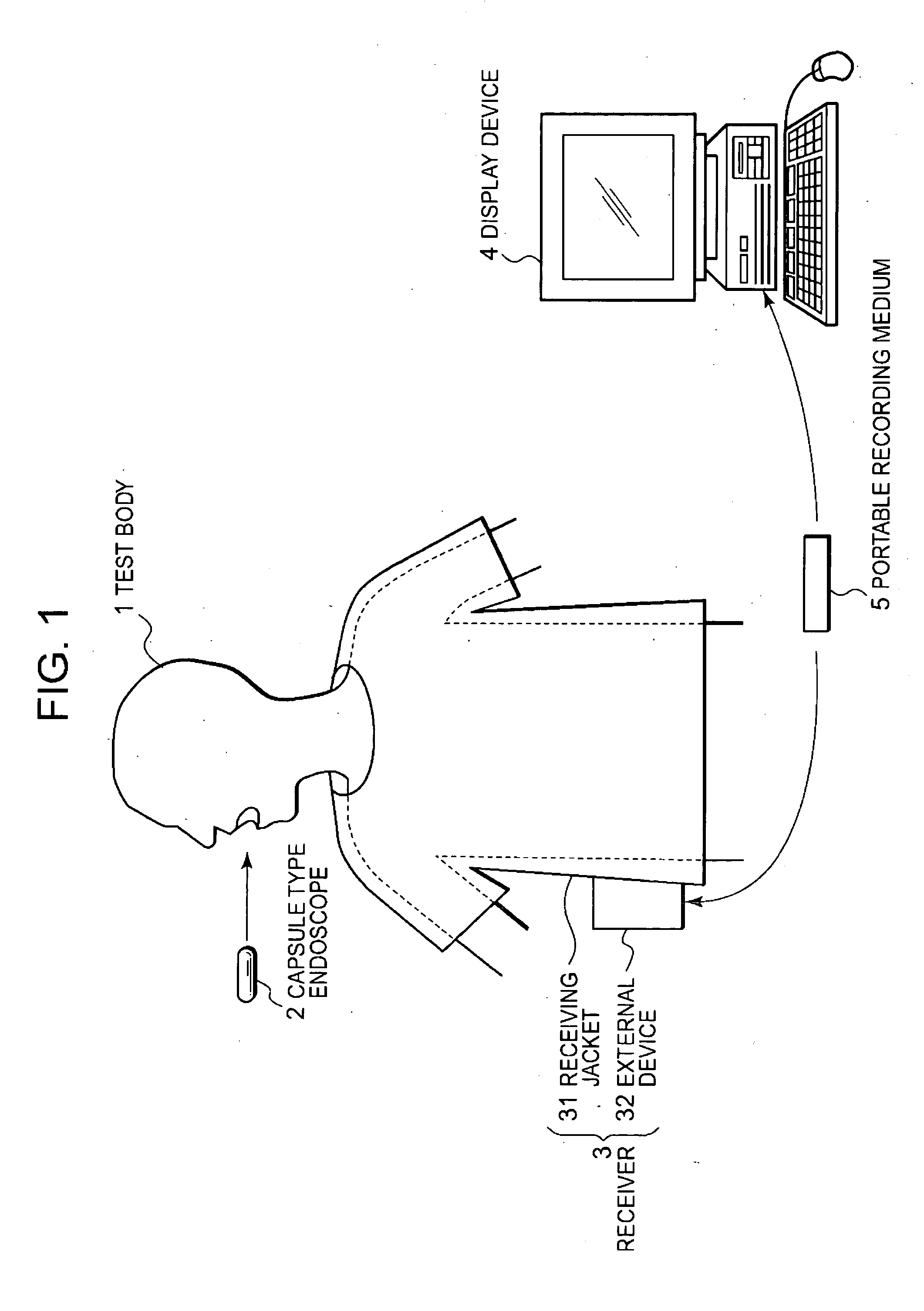 Intrabody introduced device