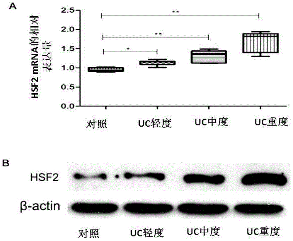 Application of human derived HSF2 as specific diagnosis molecular marker of ulcerative colitis