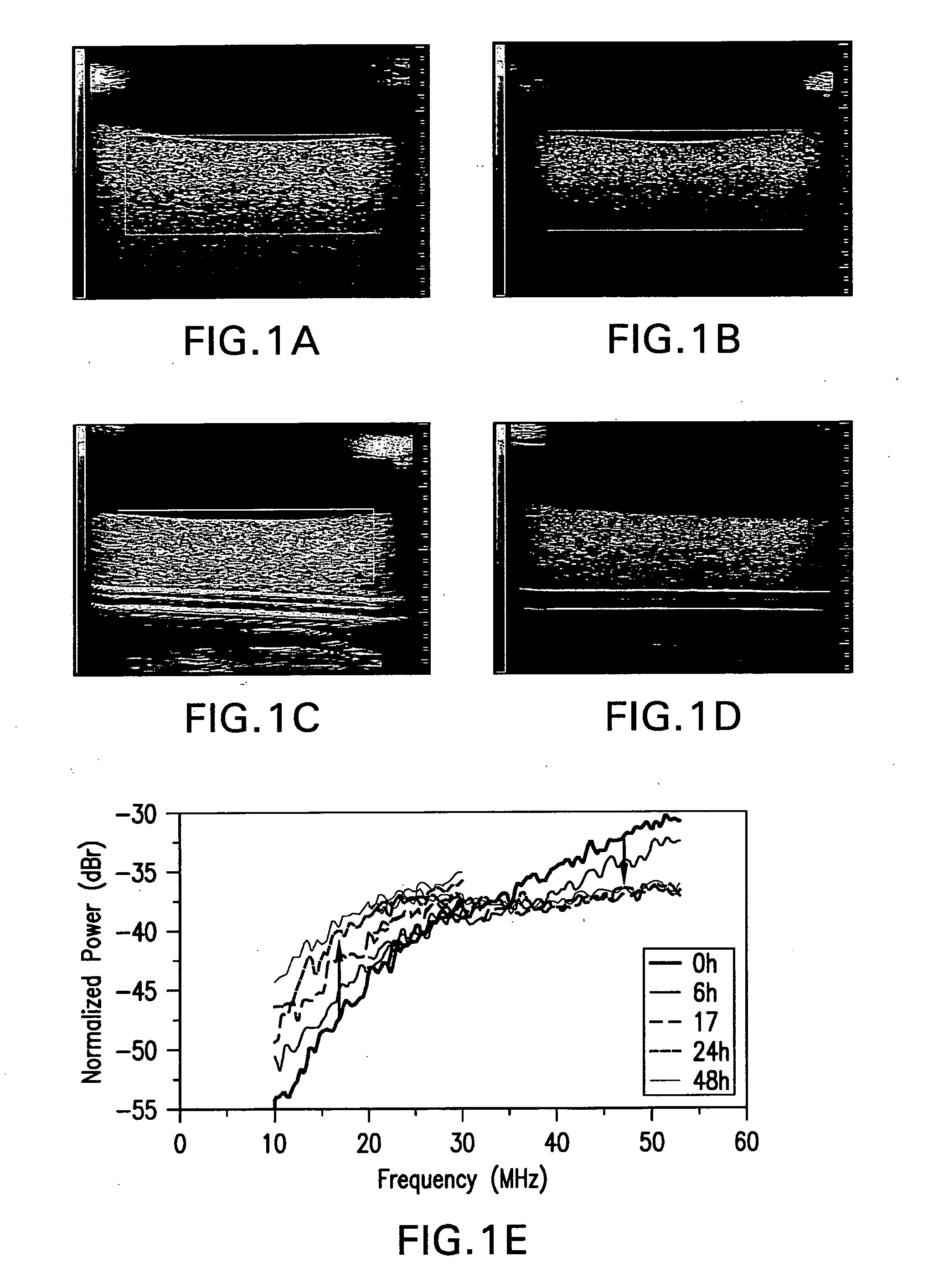 Methods of monitoring cellular death using low frequency ultrasound