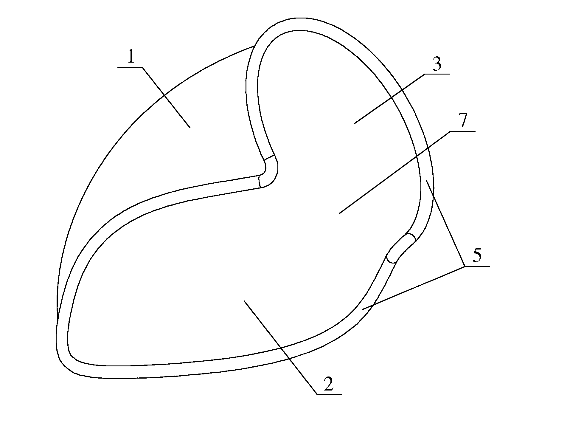 Bridge vessels-proximal anastomosis supporting device for coronary artery bypass grafting and manufacturing method thereof