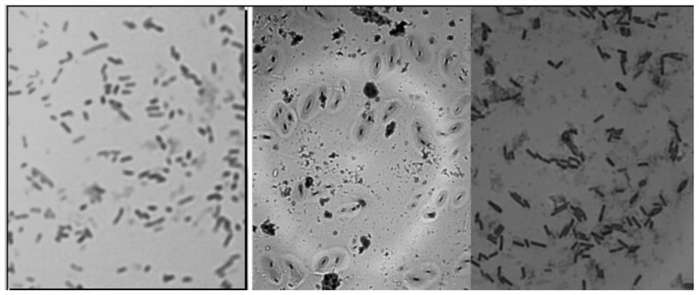 Screening method of silicate bacteria with high potassium dissolving capacity suitable for low-temperature subacid environment and potassium-dissolving bacterial fertilizer