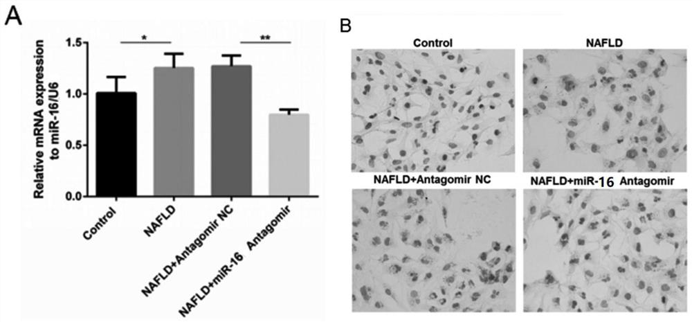 Application of mir-16 antagonist in the preparation of drugs for inhibiting non-alcoholic fatty liver disease