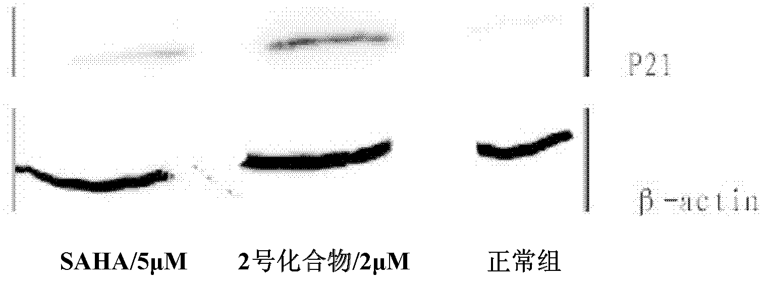 Hydroxamic acid compound and preparation method as well as application thereof