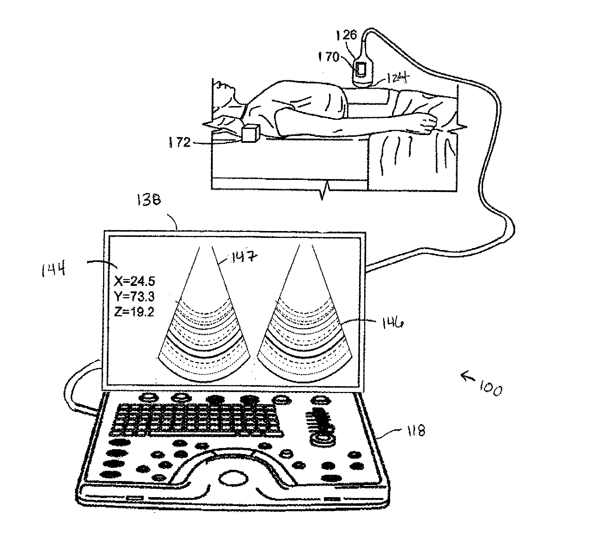 Methods and systems for display of shear-wave elastography and strain elastography images