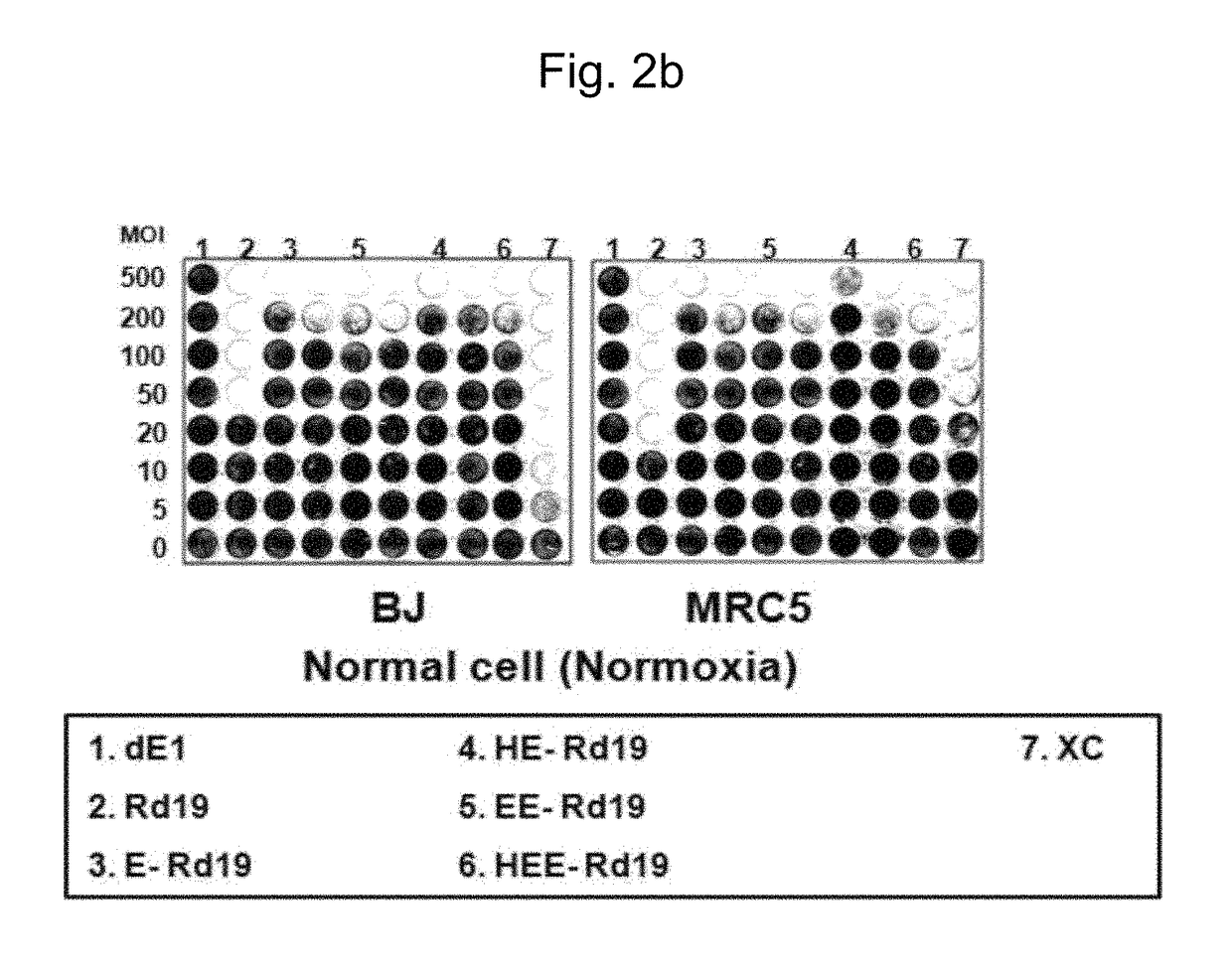 Gene delivery system having enhanced tumor-specific expression, and recombinant gene expression regulating sequence