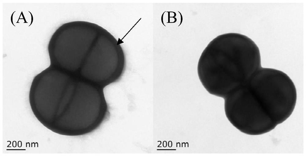 Application of a Pediococcus pentosaceae surface protein in inhibiting food-borne pathogens