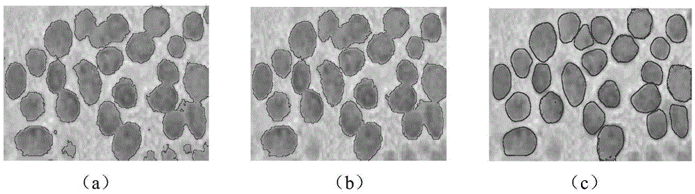 Synechia cell image segmenting method based on polyphase mutual exclusion level set