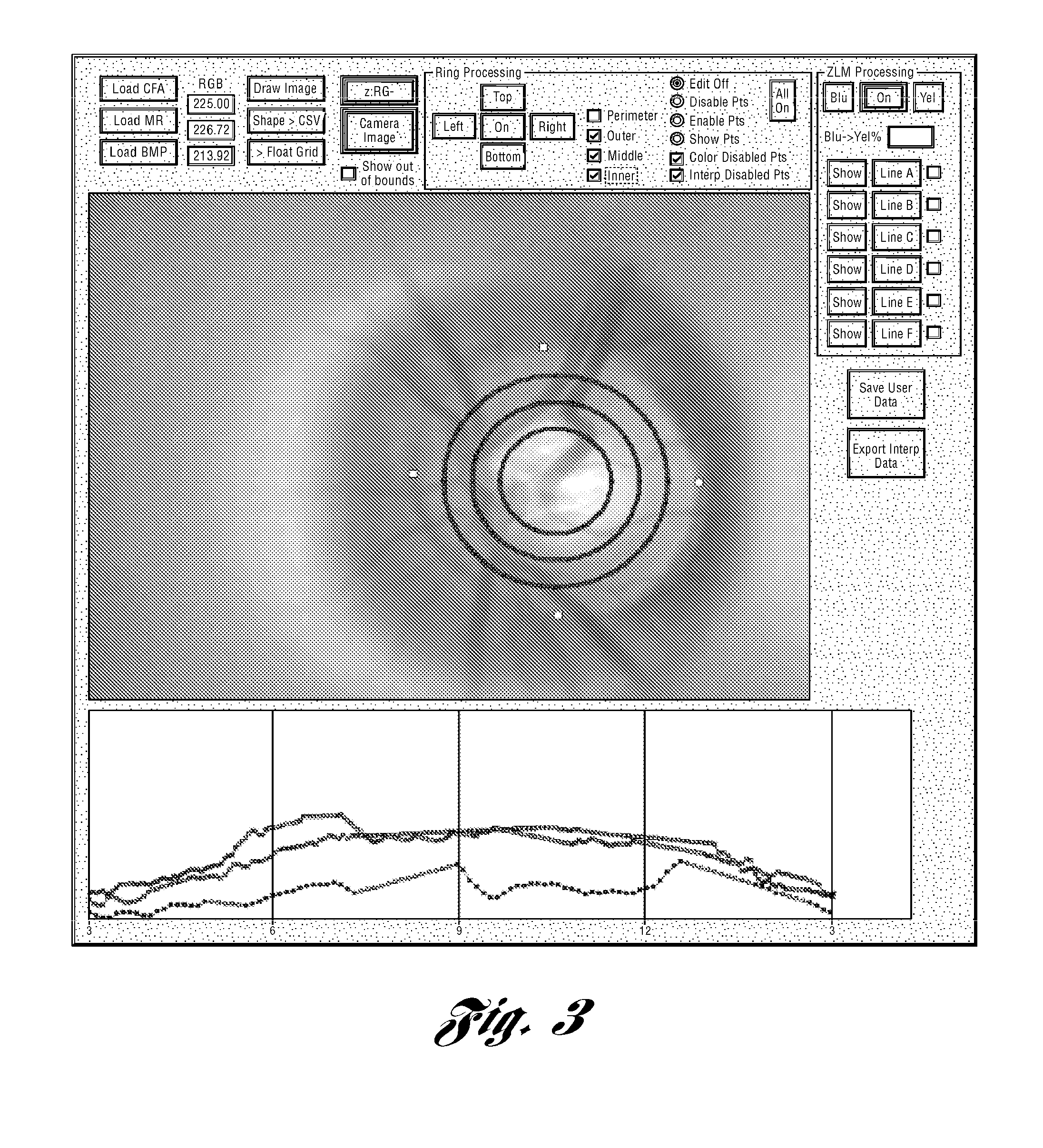 System and Method for Determining Volume-Related Parameters of Ocular and Other Biological Tissues
