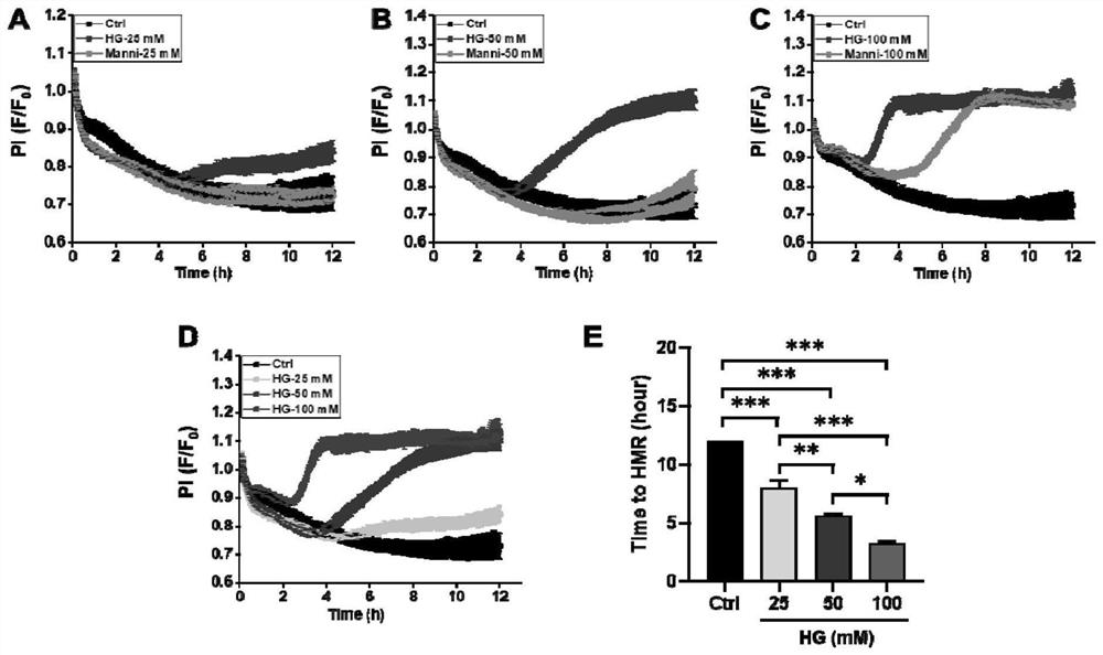 Construction method and application of acute pancreatitis cell model