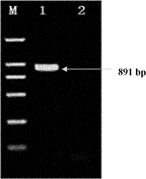 Chemiluminescent immunity imaging detection method of EV71 (Enterovirus) virus