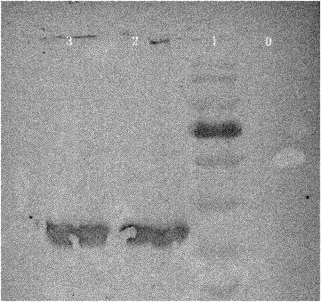 Chemiluminescent immunity imaging detection method of EV71 (Enterovirus) virus