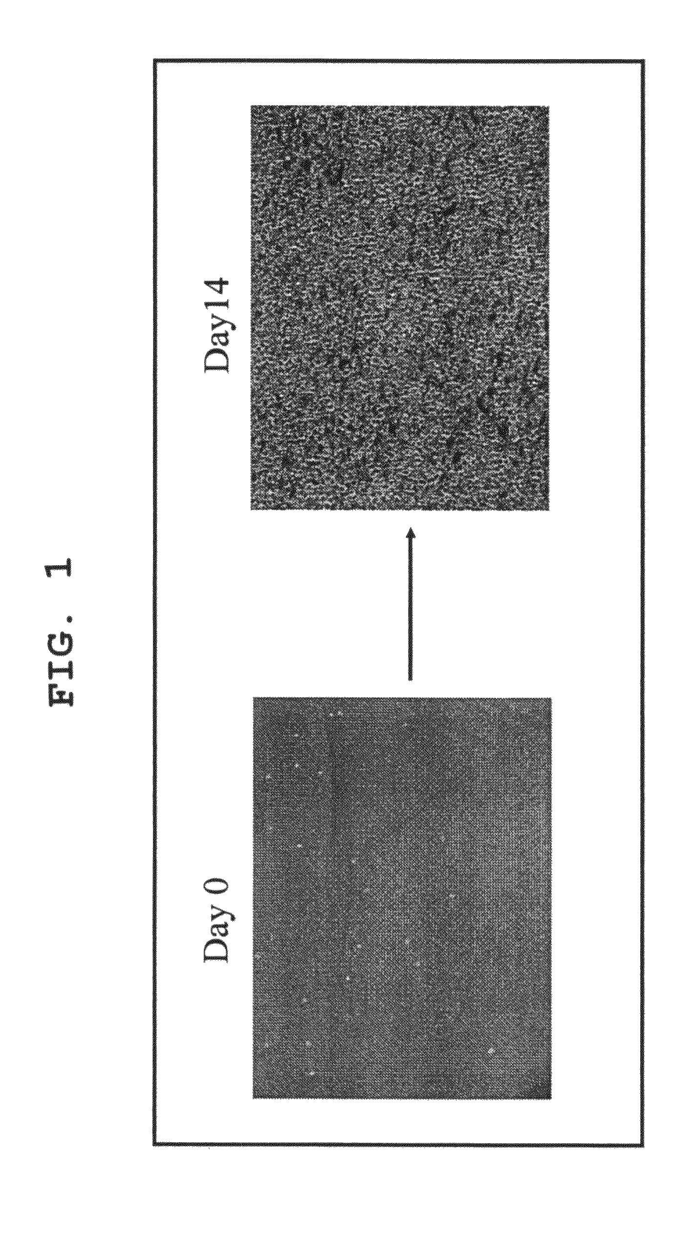 Method for amplification of endothelial progenitor cell in vitro