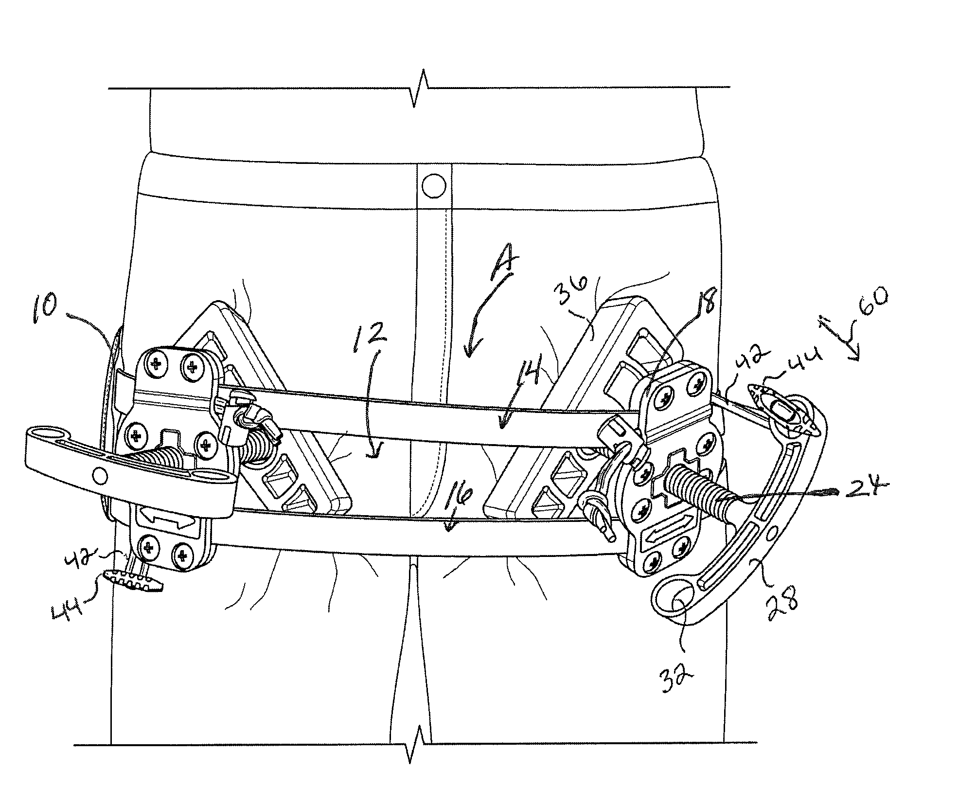 Junctional tourniquet