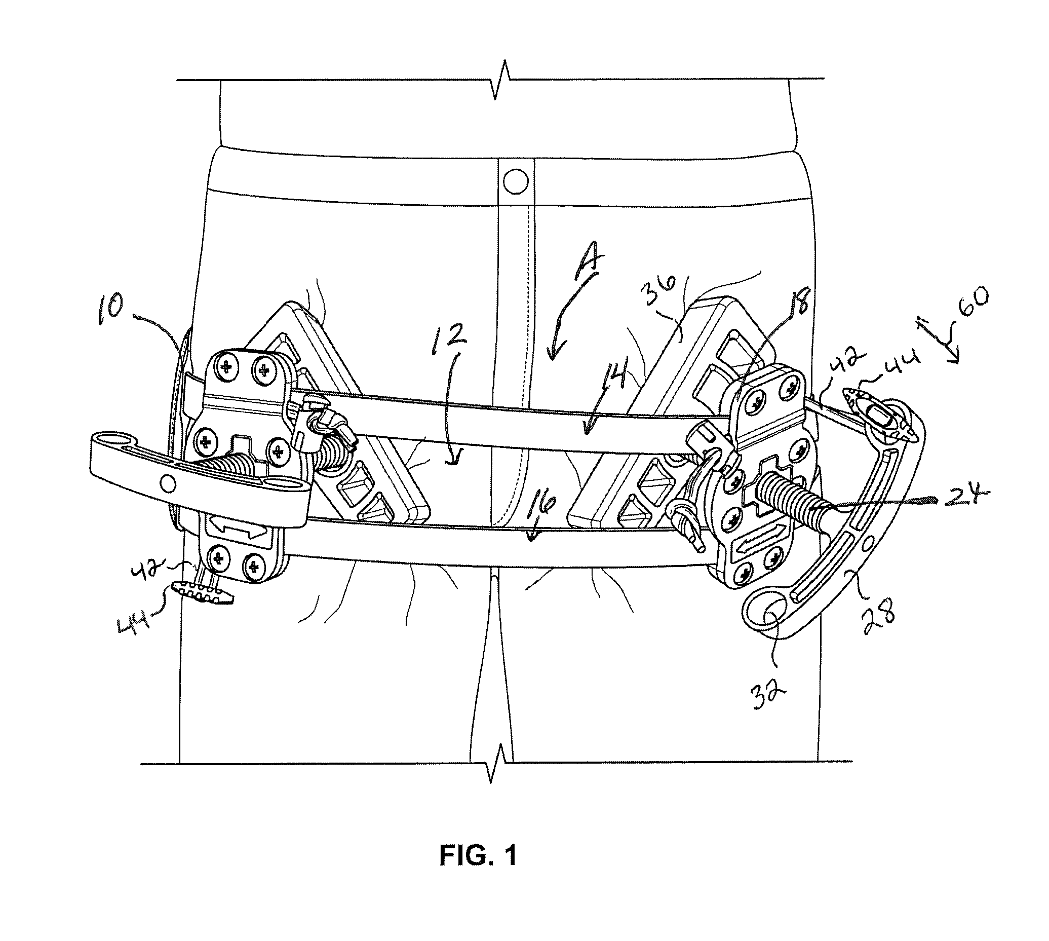 Junctional tourniquet