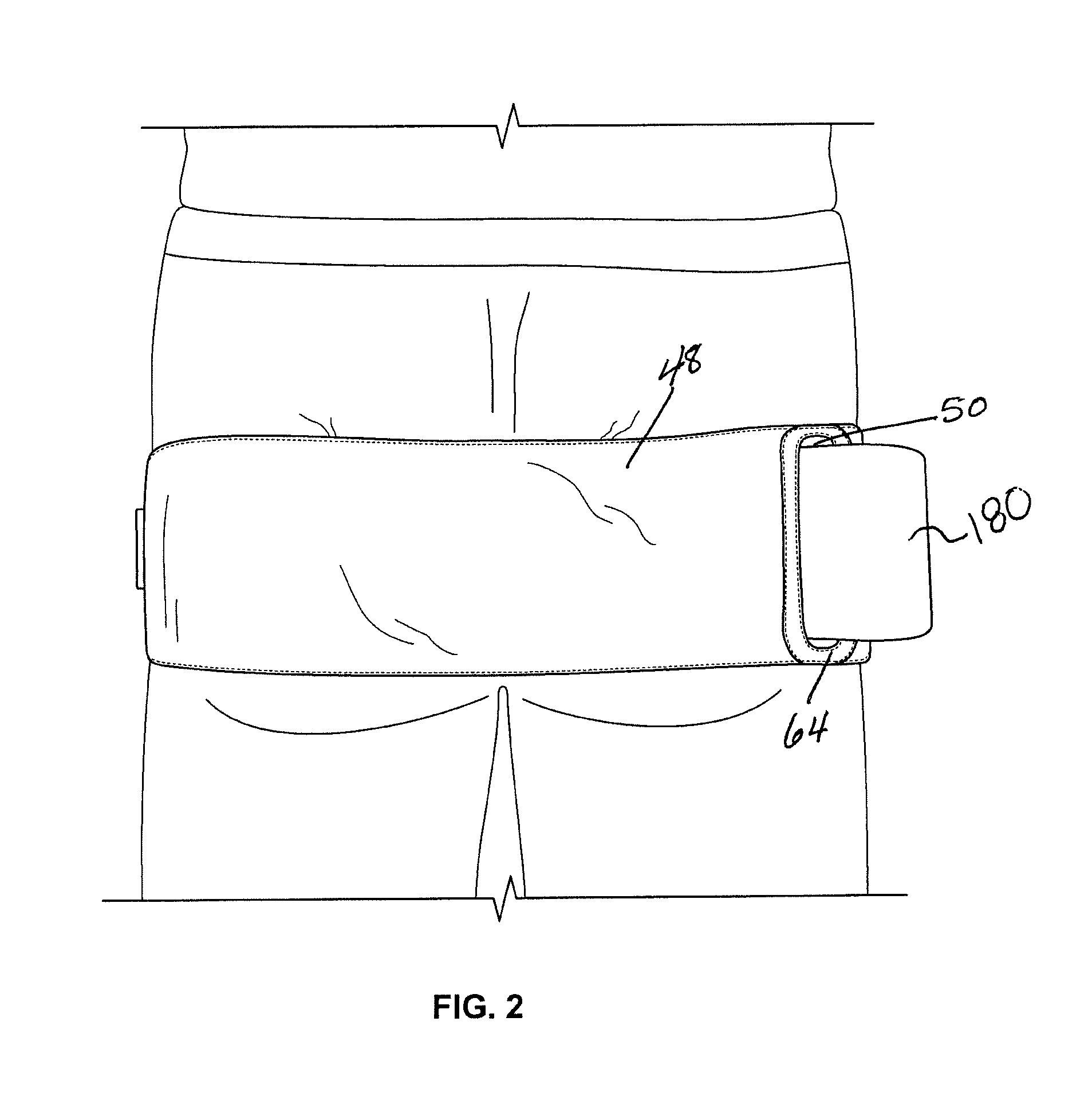 Junctional tourniquet