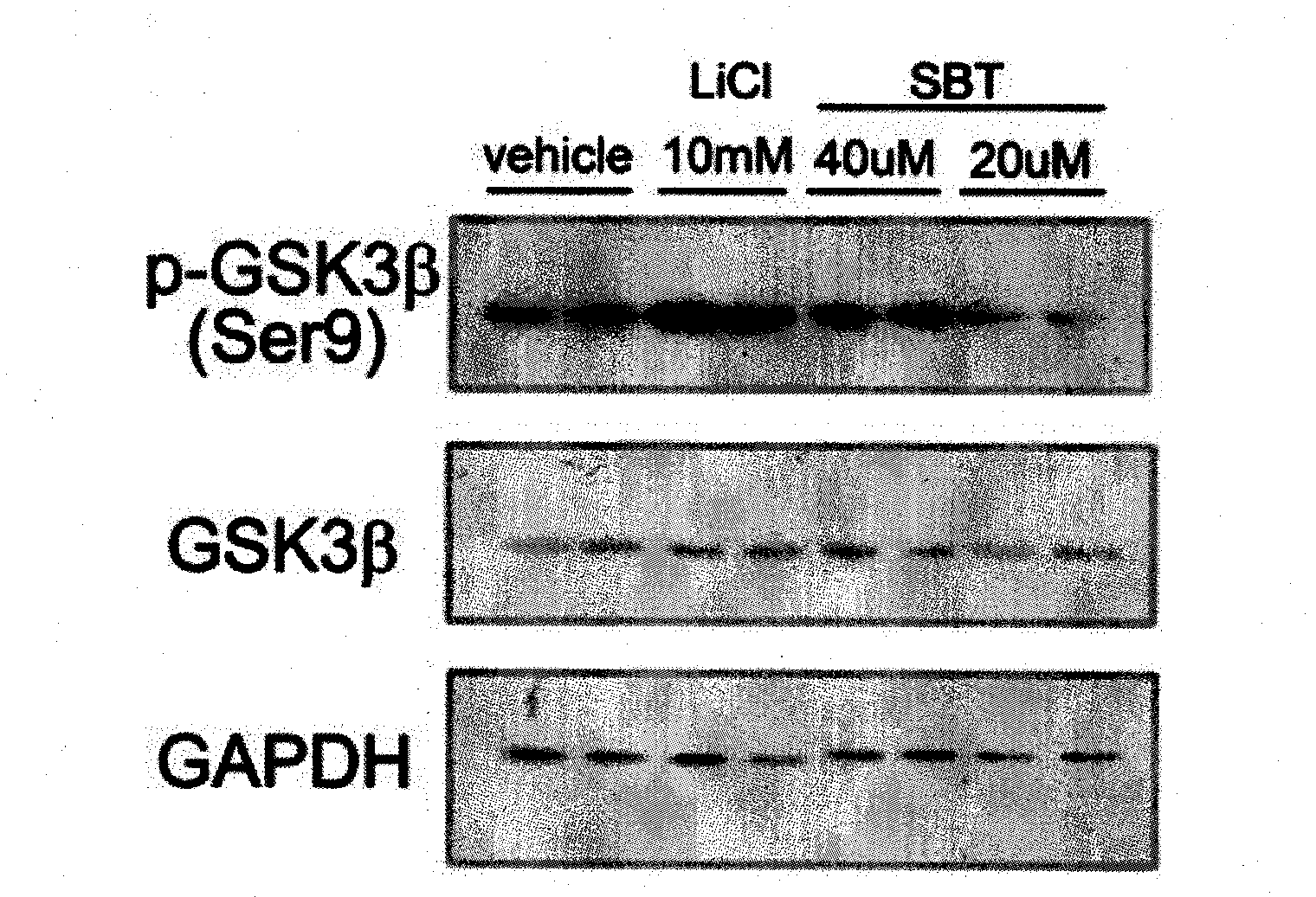 Application of SBT as inhibitor of GSK-3beta