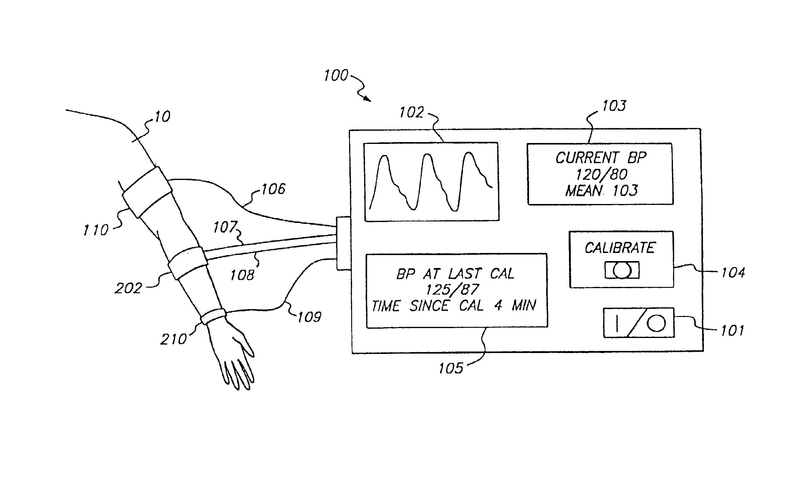 System and method of determining whether to recalibrate a blood pressure monitor