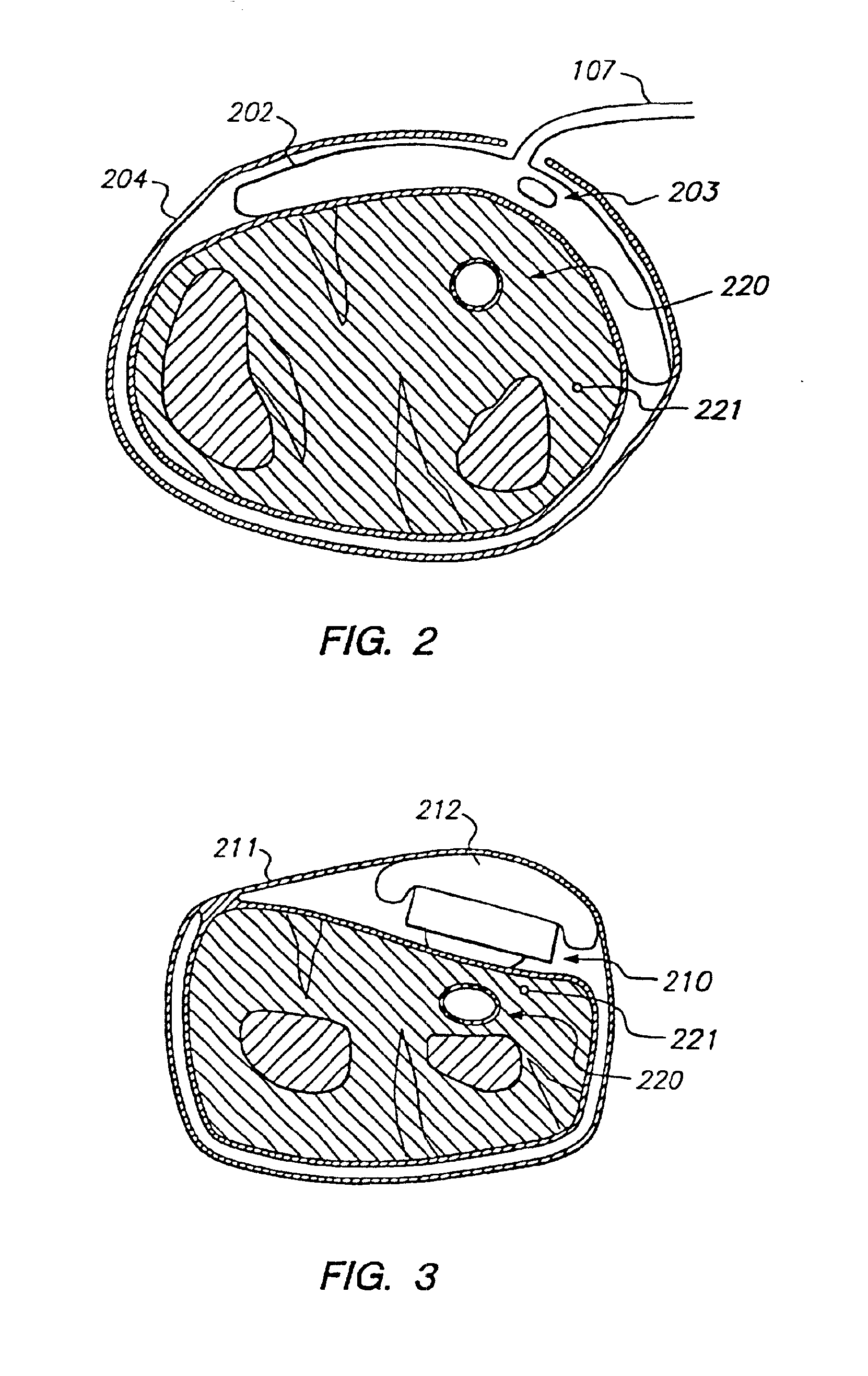 System and method of determining whether to recalibrate a blood pressure monitor