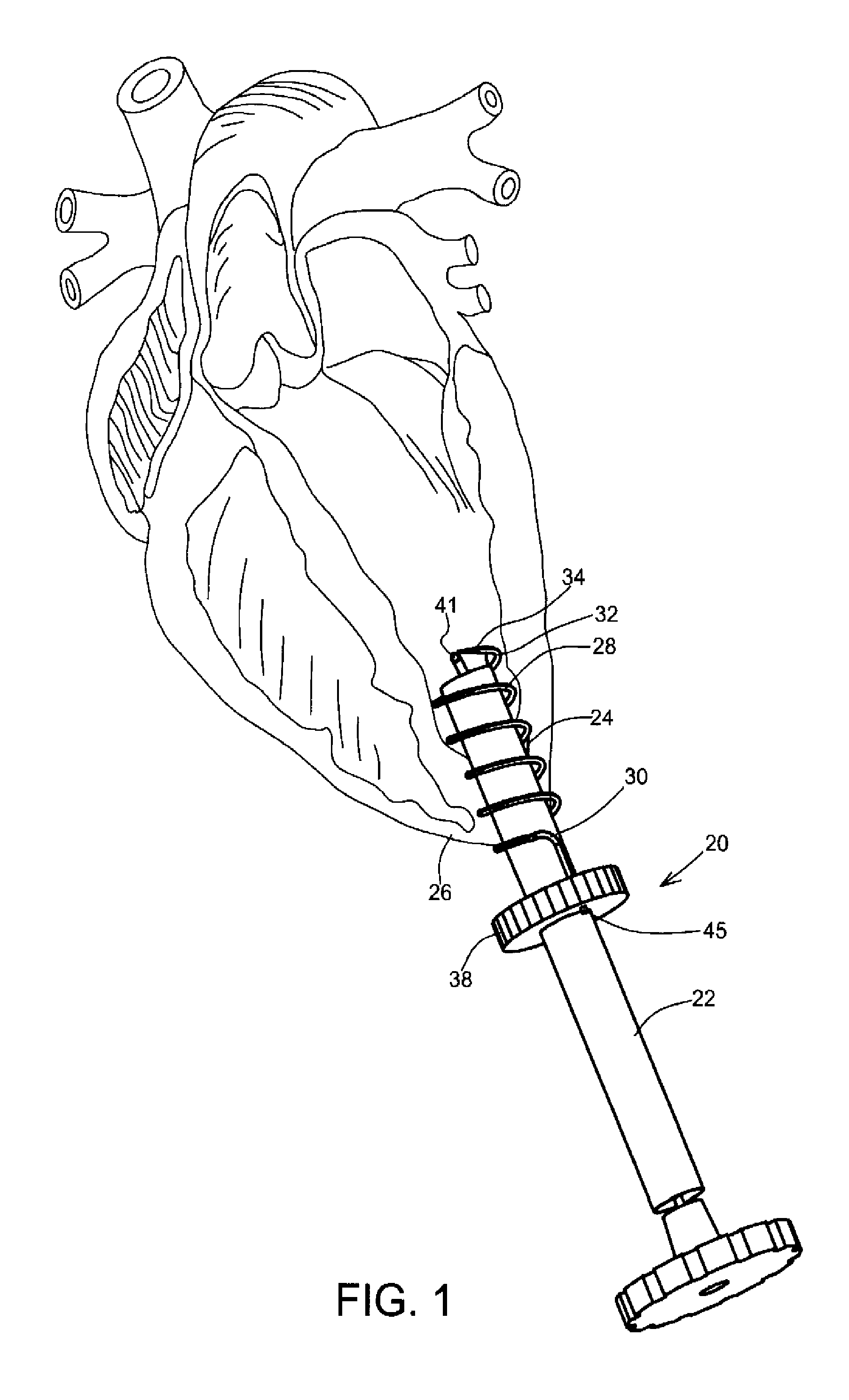 Medical suturing device and method for use thereof