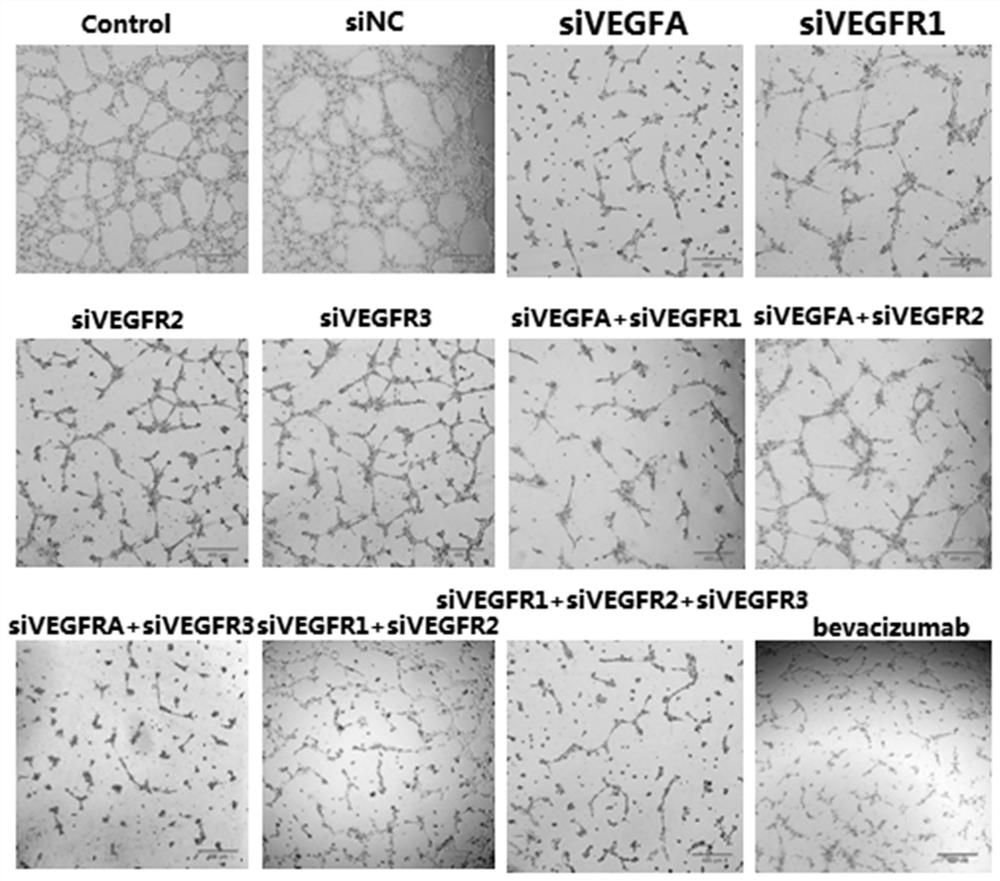 SiRNA composition for inhibiting angiogenesis