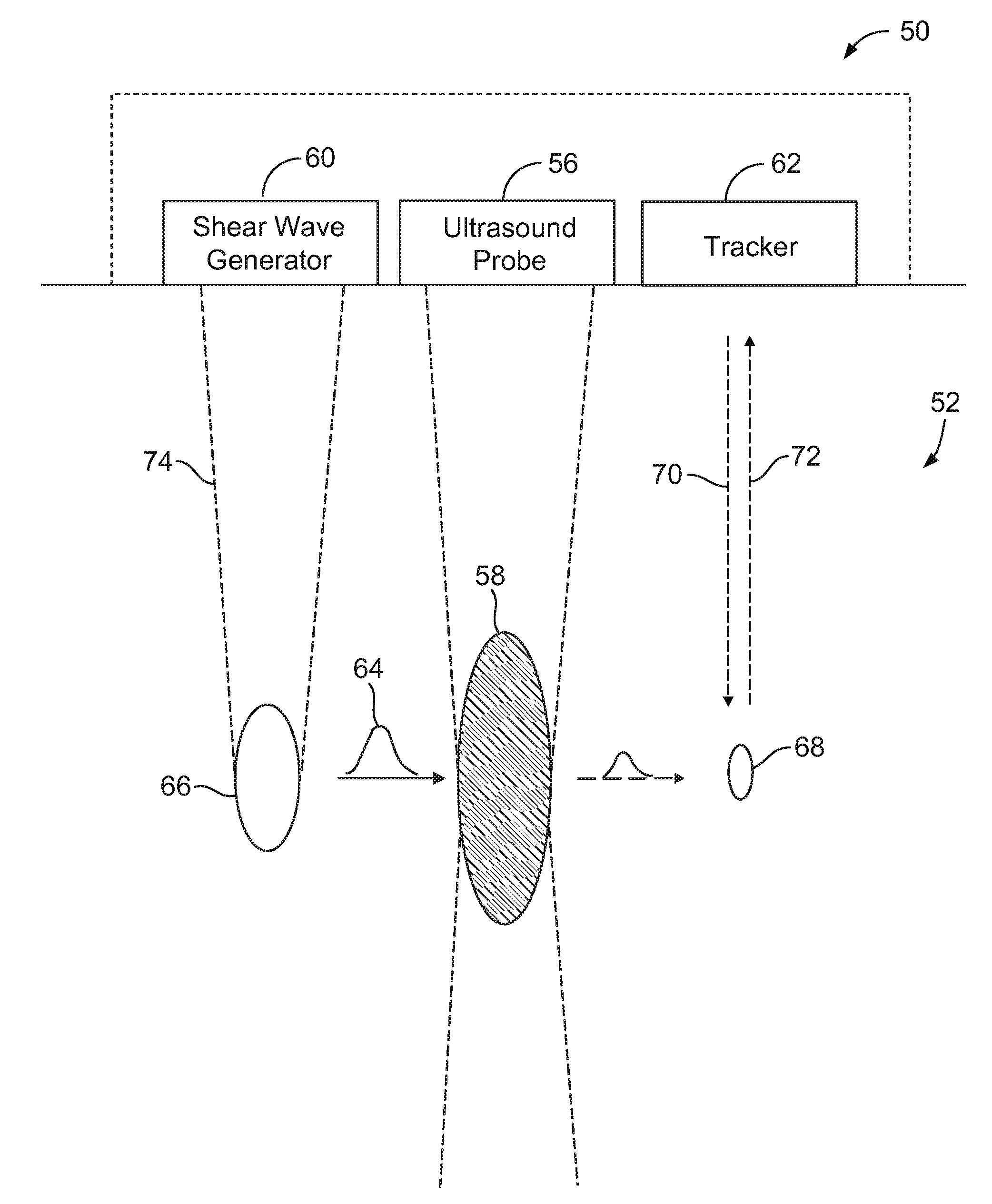 Ultrasound system and method to determine mechanical properties of a target region