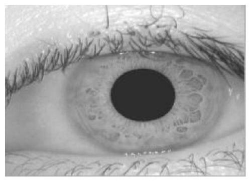 A method for quickly locating the iris of the human eye in the process of iris collection