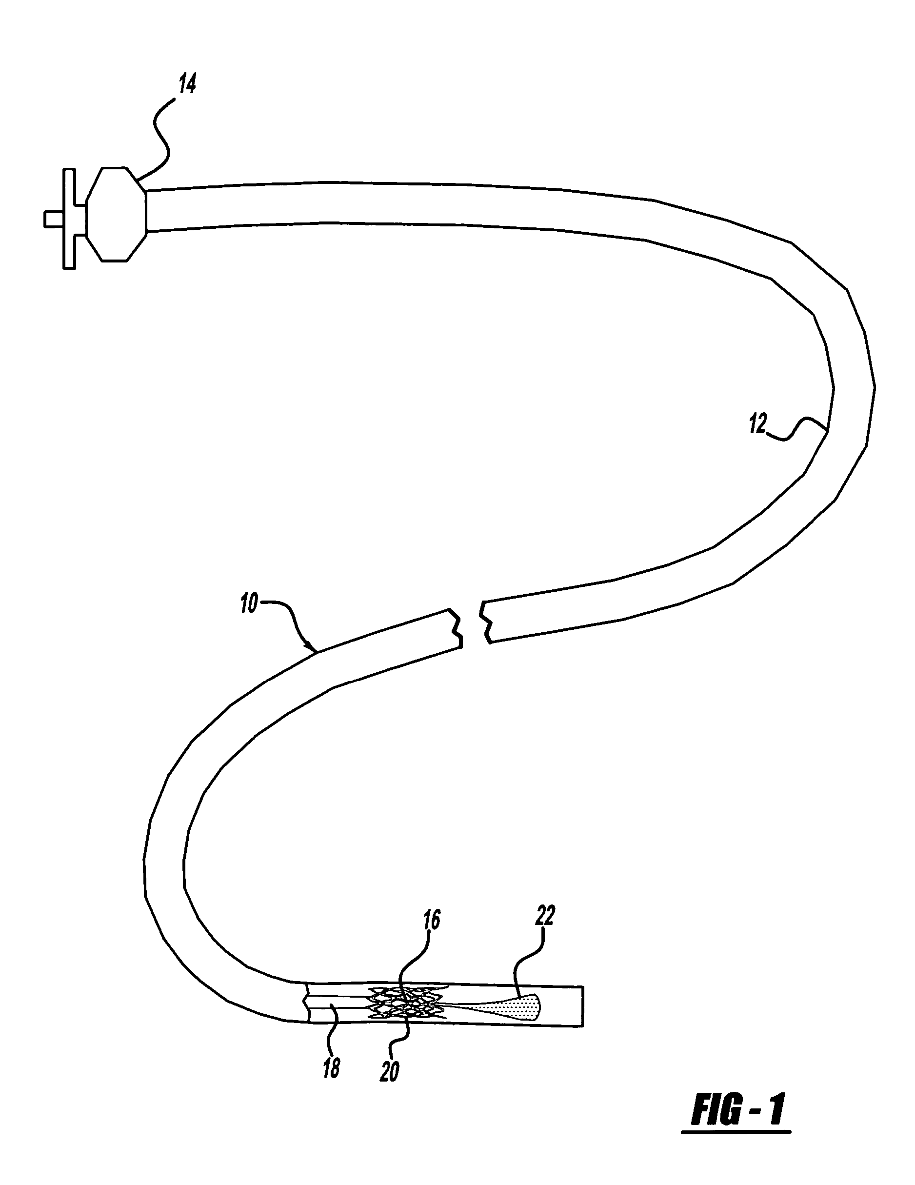 Neck covering device for an aneurysm
