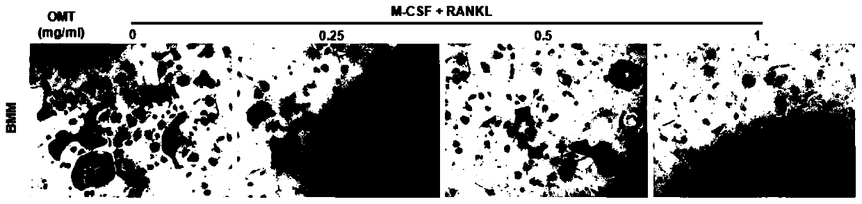 Application of oxymatrine in the preparation of anti-osteoclast-mediated bone loss drugs