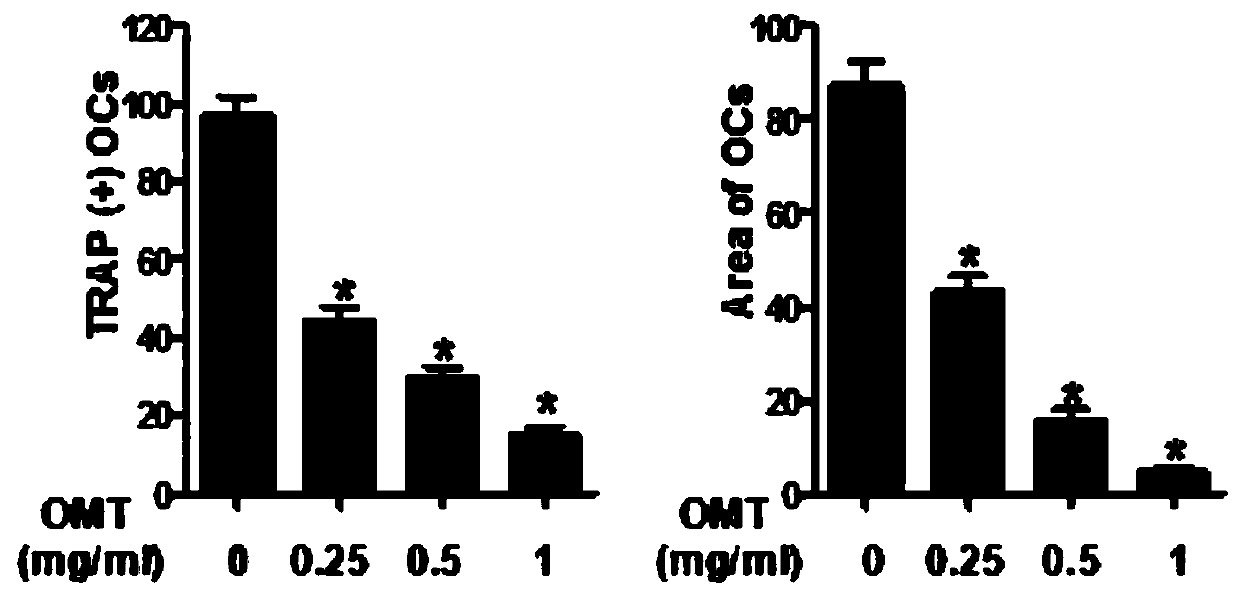 Application of oxymatrine in the preparation of anti-osteoclast-mediated bone loss drugs
