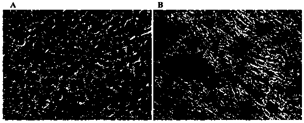 Collecting method of mesenchymal stem cells