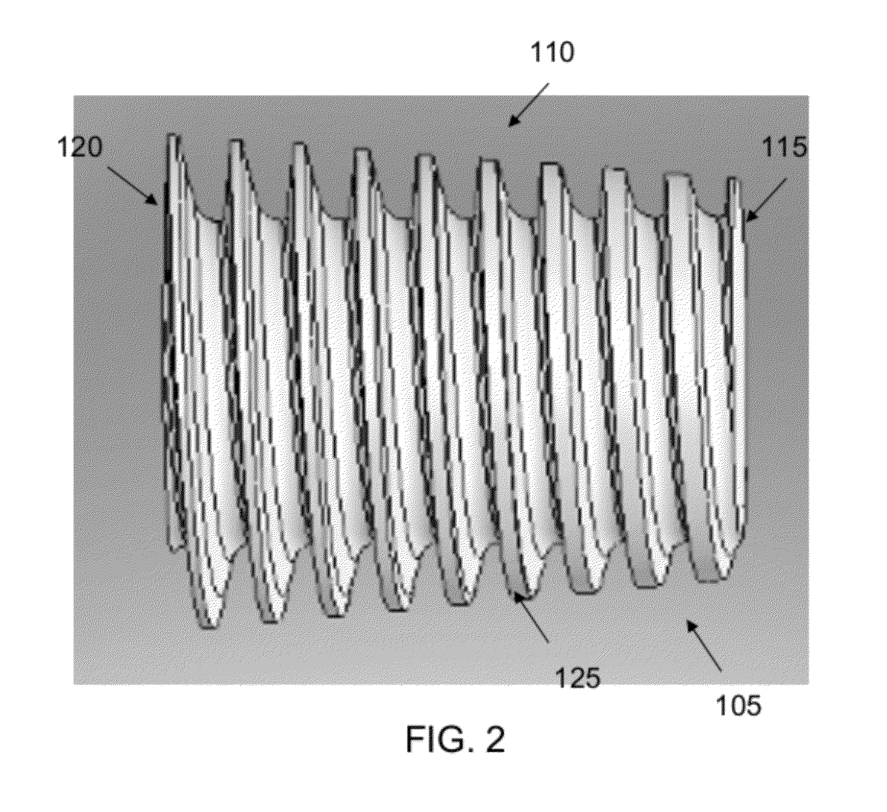 Method and apparatus for performing an open wedge osteotomy